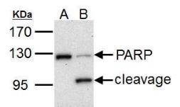 Anti-PARP antibody used in Western Blot (WB). GTX100573