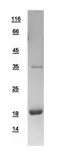 Human Prealbumin protein, His tag. GTX100577-pro