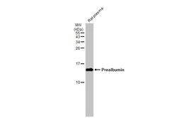 Anti-Prealbumin antibody [N1C3] used in Western Blot (WB). GTX100577