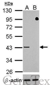 Anti-TDP43 antibody used in Western Blot (WB). GTX100579