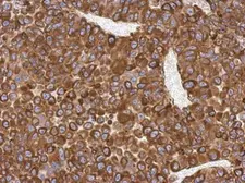 Anti-AGR3 antibody used in IHC (Paraffin sections) (IHC-P). GTX100582