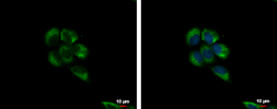 Anti-LYRIC antibody [N2C3] used in Immunocytochemistry/ Immunofluorescence (ICC/IF). GTX100587