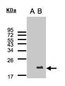 Anti-UBE2C antibody [N1C3] used in Western Blot (WB). GTX100599
