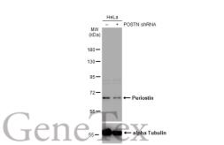 Anti-Periostin antibody used in Western Blot (WB). GTX100602