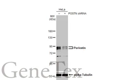 Anti-Periostin antibody used in Western Blot (WB). GTX100602
