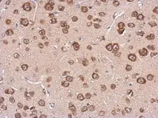 Anti-Cystatin F antibody used in IHC (Paraffin sections) (IHC-P). GTX100613