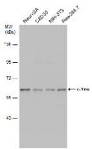Anti-c-Yes antibody used in Western Blot (WB). GTX100616