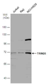 Anti-TRIM25 antibody [N2C1], Internal used in Western Blot (WB). GTX100617