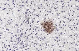 Anti-Wnt5a antibody used in IHC (Paraffin sections) (IHC-P). GTX100618