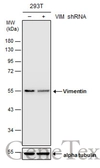 Anti-Vimentin antibody used in Western Blot (WB). GTX100619