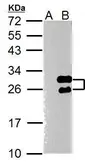 Anti-Twist1 antibody [N1C3] used in Western Blot (WB). GTX100621