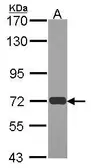 Anti-RAD54L antibody [N1N2-2], N-term used in Western Blot (WB). GTX100624
