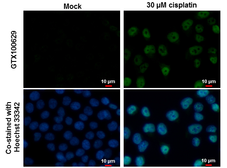 Anti-p53 antibody [N1], N-term used in Immunocytochemistry/ Immunofluorescence (ICC/IF). GTX100629