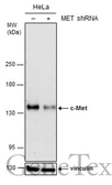 Anti-c-Met antibody [C3], C-term used in Western Blot (WB). GTX100637