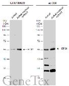 Anti-ETS1 antibody used in Western Blot (WB). GTX100639