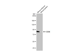 Anti-CD36 antibody [C1C3] used in Western Blot (WB). GTX100642