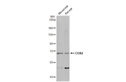 Anti-COX2 antibody [C3], C-term used in Western Blot (WB). GTX100656