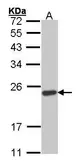 Anti-SOCS1 antibody used in Western Blot (WB). GTX100657