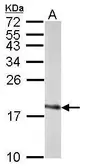 Anti-SOD1 antibody used in Western Blot (WB). GTX100659
