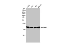 Anti-SOD1 antibody used in Western Blot (WB). GTX100659