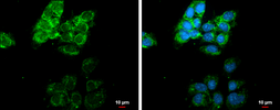 Anti-MMP13 antibody [N3C1], Internal used in Immunocytochemistry/ Immunofluorescence (ICC/IF). GTX100665