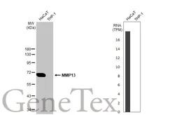 Anti-MMP13 antibody [N3C1], Internal used in Western Blot (WB). GTX100665