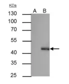Anti-C/EBP alpha antibody [N1], N-term used in Immunoprecipitation (IP). GTX100674
