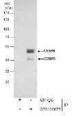 Anti-C/EBP beta antibody used in Immunoprecipitation (IP). GTX100675