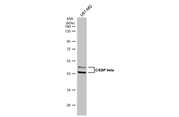 Anti-C/EBP beta antibody used in Western Blot (WB). GTX100675