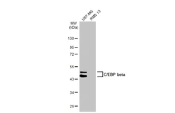Anti-C/EBP beta antibody used in Western Blot (WB). GTX100675