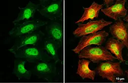 Anti-C/EBP beta antibody used in Immunocytochemistry/ Immunofluorescence (ICC/IF). GTX100675