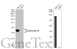 Anti-Cytokeratin 20 antibody [C2C3], C-term used in Western Blot (WB). GTX100693