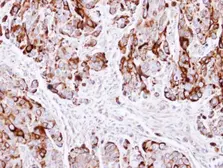 Anti-Cytokeratin 20 antibody [C2C3], C-term used in IHC (Paraffin sections) (IHC-P). GTX100693