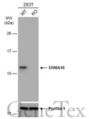 Anti-S100A10 antibody used in Western Blot (WB). GTX100697