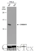 Anti-S100A11 antibody used in Western Blot (WB). GTX100698