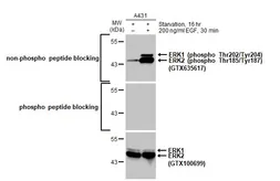 Anti-ERK1 antibody used in Western Blot (WB). GTX100699