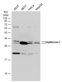 Anti-Kallikrein 7 antibody used in Western Blot (WB). GTX100700