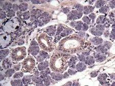 Anti-MMP3 antibody [N1], N-term used in IHC (Paraffin sections) (IHC-P). GTX100706