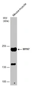Anti-MYH7 antibody [N1], N-term used in Western Blot (WB). GTX100713