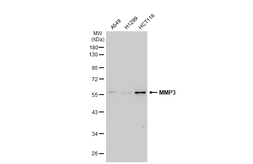 Anti-MMP3 antibody [N3C1], Internal used in Western Blot (WB). GTX100723