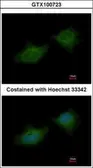 Anti-MMP3 antibody [N3C1], Internal used in Immunocytochemistry/ Immunofluorescence (ICC/IF). GTX100723