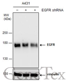 Anti-EGFR antibody [N1], N-term used in Western Blot (WB). GTX100725