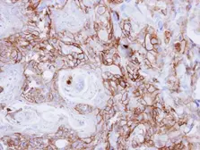 Anti-EGFR antibody [N1], N-term used in IHC (Paraffin sections) (IHC-P). GTX100725