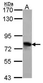 Anti-TGFBI antibody [C1C3] used in Western Blot (WB). GTX100744