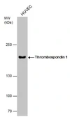 Anti-Thrombospondin 1 antibody [C1C3] used in Western Blot (WB). GTX100746