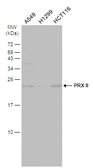 Anti-PRX II antibody used in Western Blot (WB). GTX100747