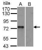 Anti-Syk antibody [N2C2], Internal used in Western Blot (WB). GTX100748