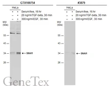 Anti-SNAI1 antibody used in Western Blot (WB). GTX100754
