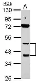 Anti-Retinoic Acid Receptor beta antibody used in Western Blot (WB). GTX100759