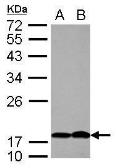 Anti-PTHLH antibody [N1C3] used in Western Blot (WB). GTX100762